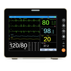 An ekg