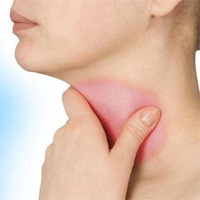 ESL Vocab - The Throat